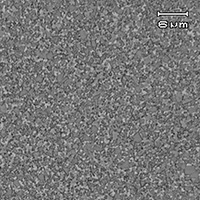 Micrographs of KN 20  By metallurgical microscope(×1000)